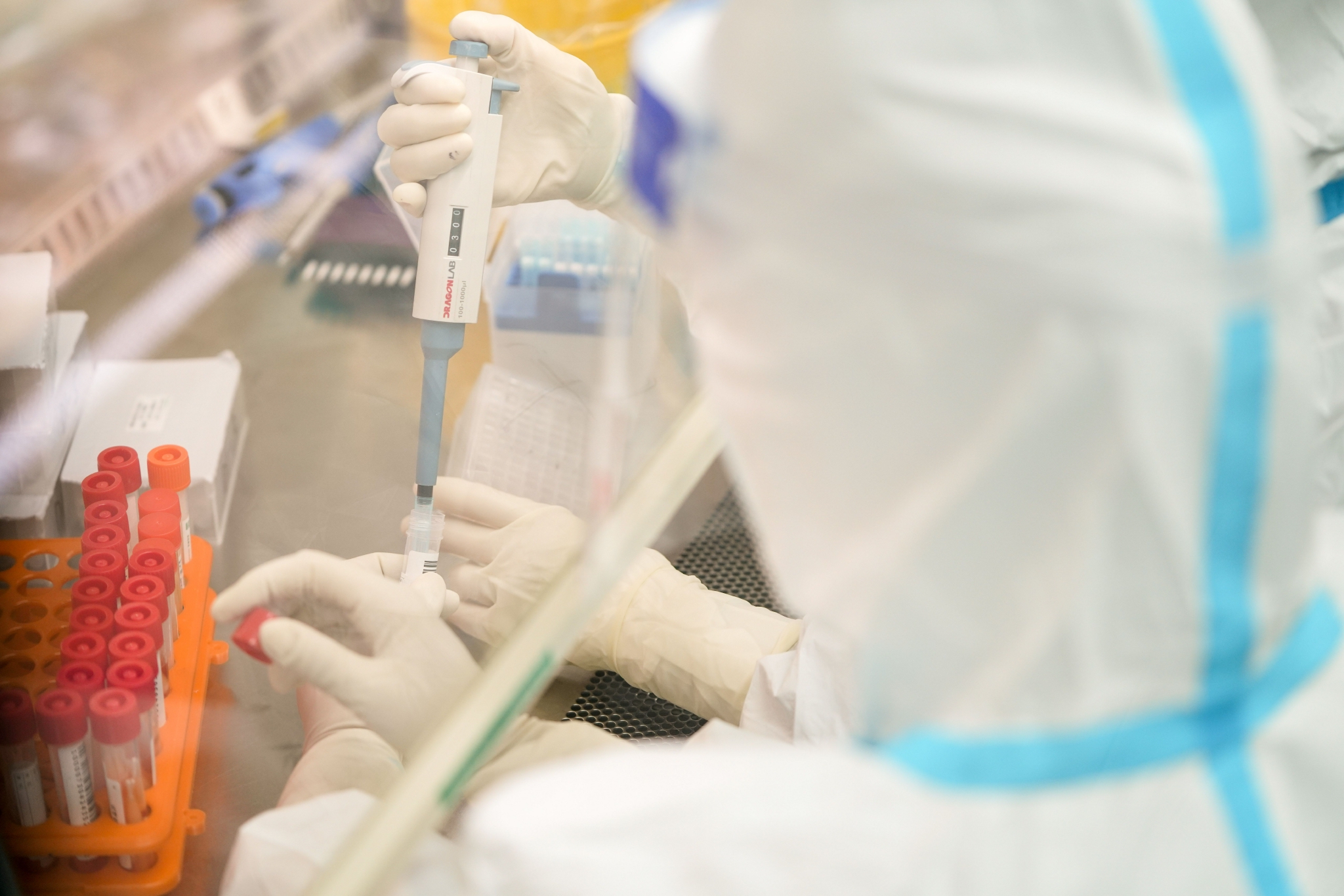 31省新增本土49例/31省新增69例 本土48例-第1张图片