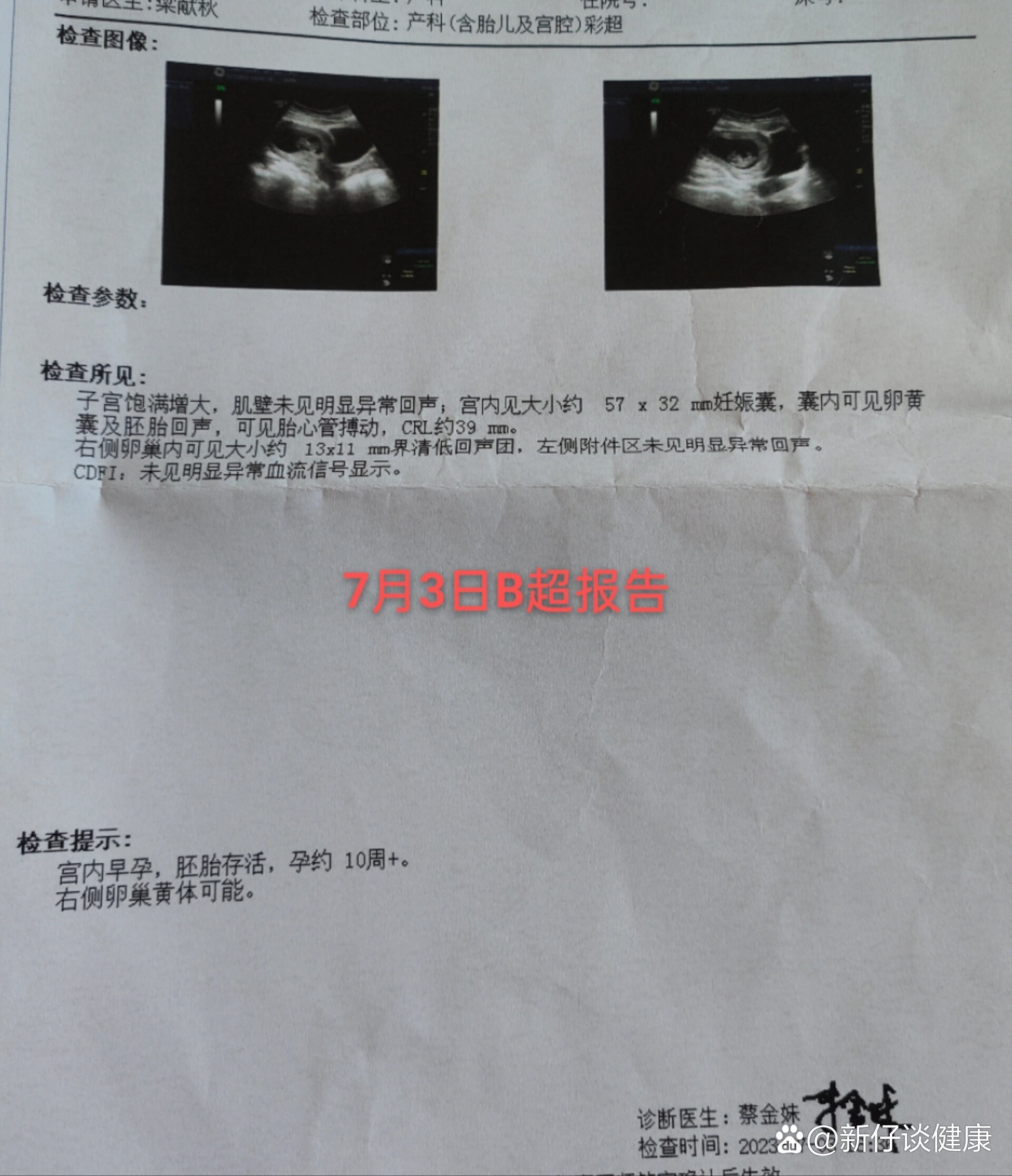 【郑州出现一例阳性,郑州1例】-第1张图片